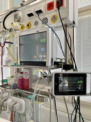 Přerovská nemocnice má nové přístroje pro sledování životně důležitých funkcí